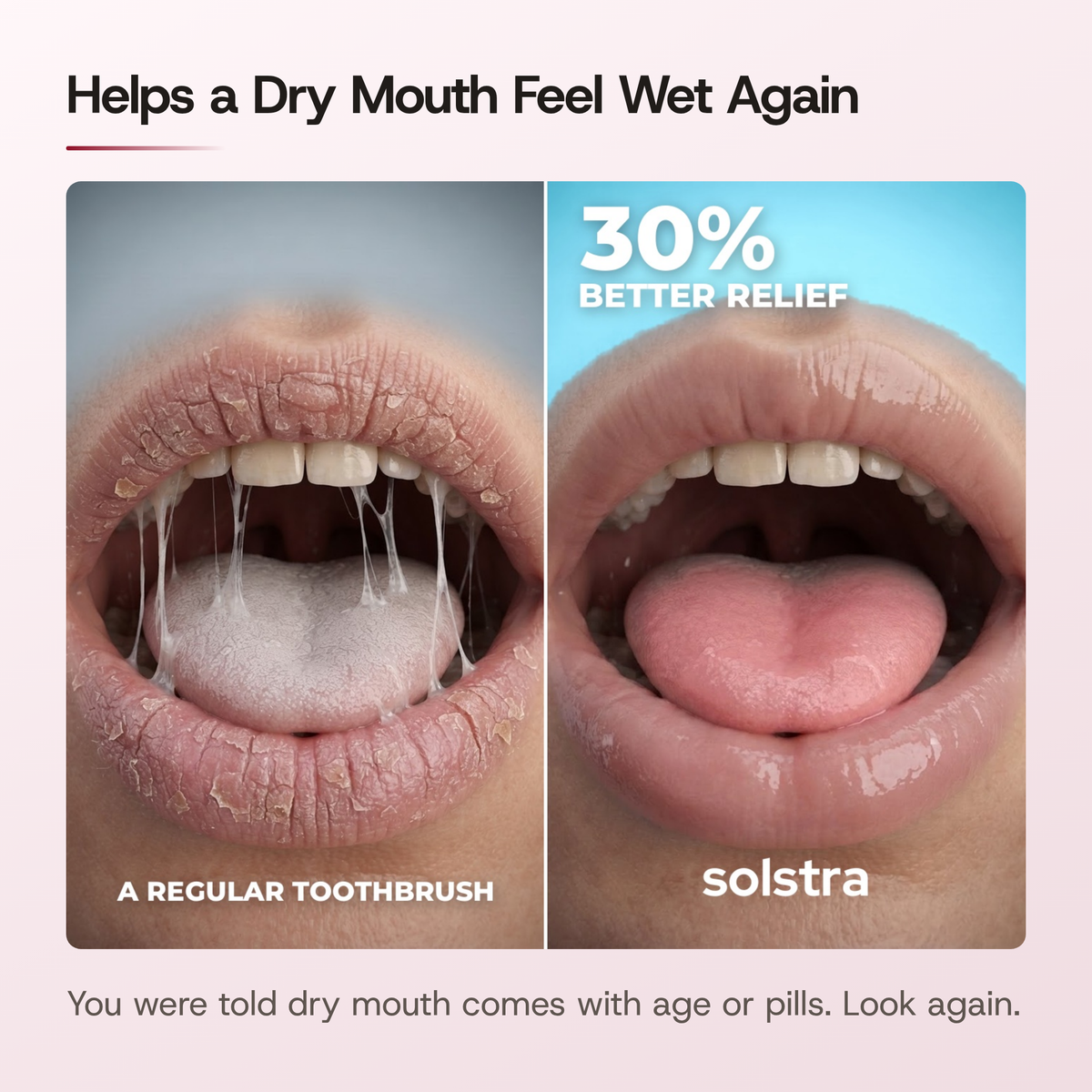 Helps a dry mouth feel wet again. Left, a regular toothbrush: cracked lips and a dry, coated tongue. Right, SOLSTRA: a moist, pink mouth, with 30% better relief.